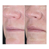 OURSELF Replenishing Lip Filler With Refill - NextGen