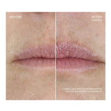 OURSELF Replenishing Lip Filler With Refill - NextGen