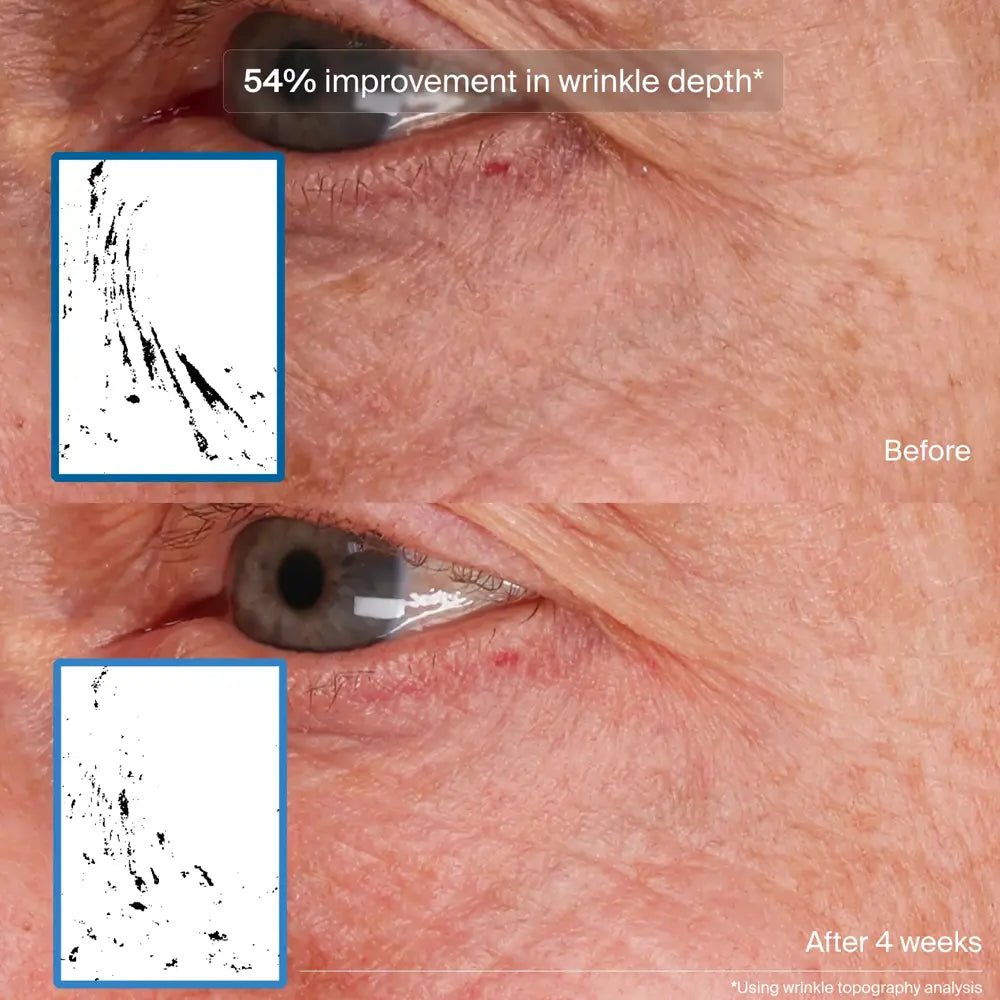Pavise Bioadaptive Stress Repair