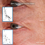 Pavise Bioadaptive Stress Repair