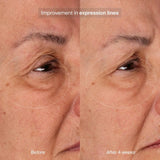 Pavise Bioadaptive Stress Repair