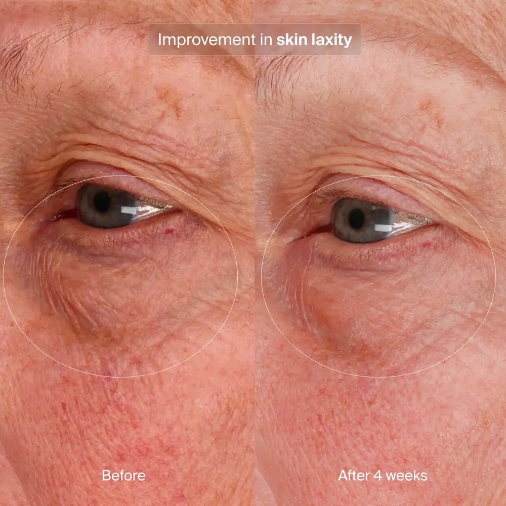 Pavise Bioadaptive Stress Repair