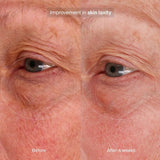 Pavise Bioadaptive Stress Repair