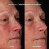 Pavise Bioadaptive Stress Repair