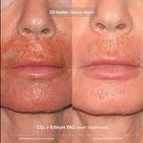Pavise Extracellular Matrix Restore
