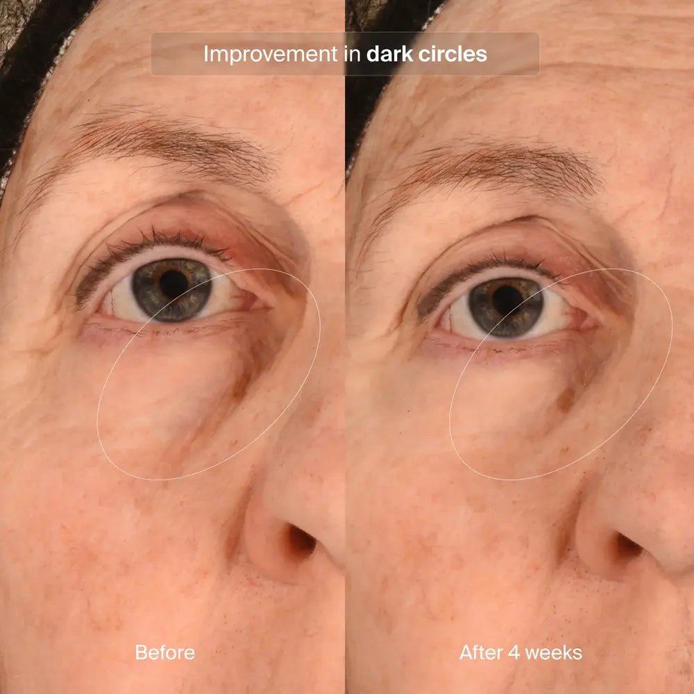 Pavise Precision Eye Lift