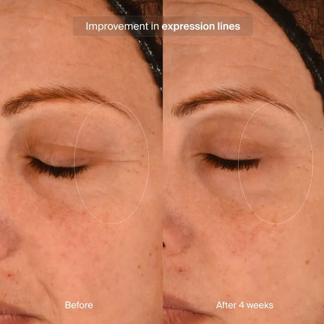 Pavise Precision Eye Lift