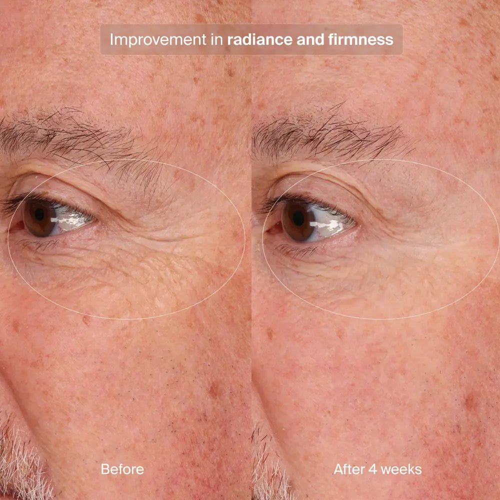 Pavise Precision Eye Lift