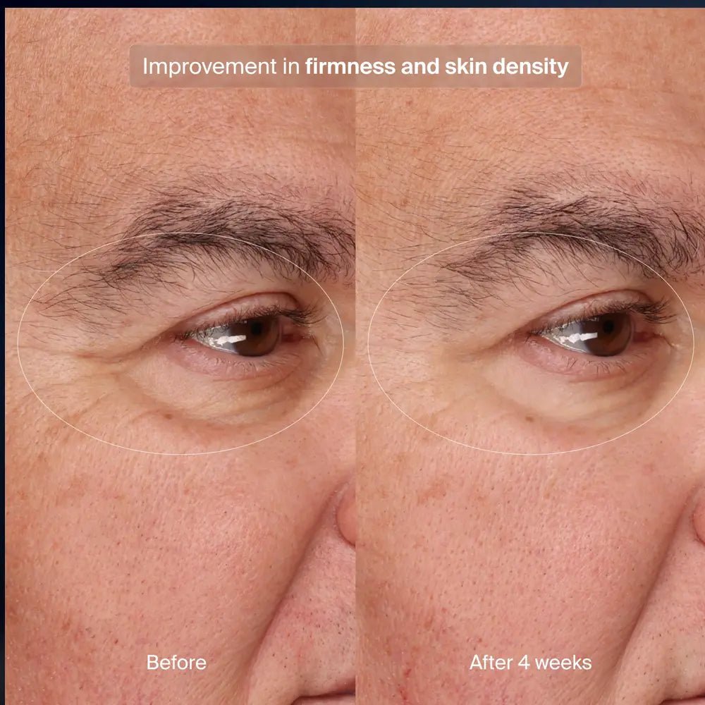 Pavise Precision Eye Lift