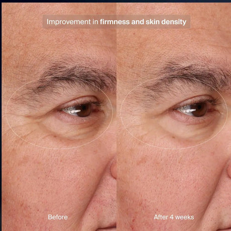 Pavise Precision Eye Lift