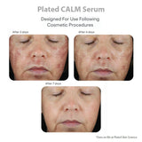 Plated Skin Science CALM Serum - Your Skincare Source