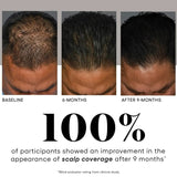 Before and after comparison of scalp coverage improvement over 9 months with a 100% success rate.
