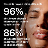 Revision Skincare Advanced Pigment Corrector+ serum 'Tested & Proven Clinical Results,' '96% of subjects showed improvement in dark spot intensity,' and '86% of subjects saw visible improvement in dark spot appearance.
