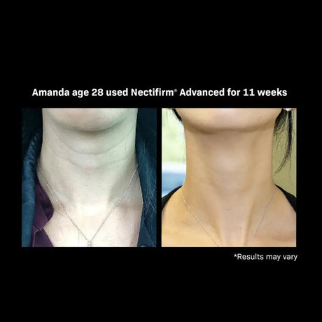 Nectifirm ADVANCED results on 28 yo - Your Skincare Source