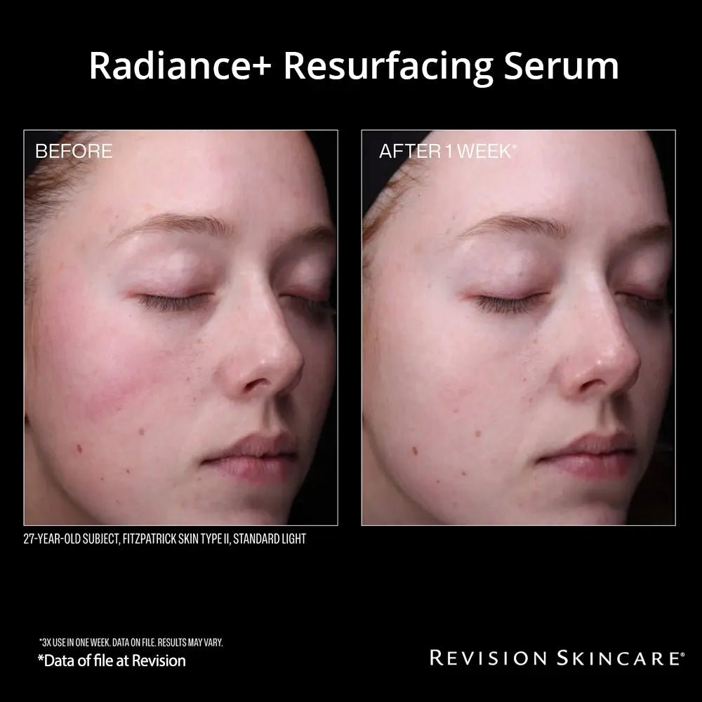 Before and after effects of Radiance+ Resurfacing Serum on a woman's face by Revision Skincare.
