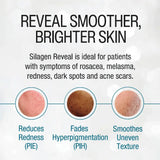 Silagen Reveal skin treatment showing before and after results on skin conditions.