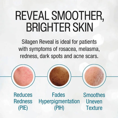 Silagen Reveal skin treatment showing before and after results on skin conditions.