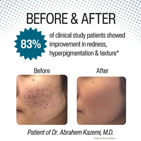 Silagen Reveal before and after skin treatment comparison with 83% improvement rate