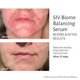 SIV Biome Balancing Serum