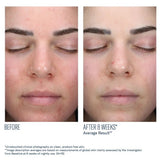 SkinBetter AlphaRet Clearing Serum