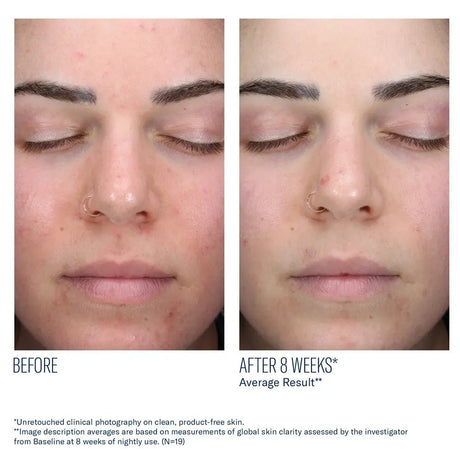 SkinBetter AlphaRet Clearing Serum