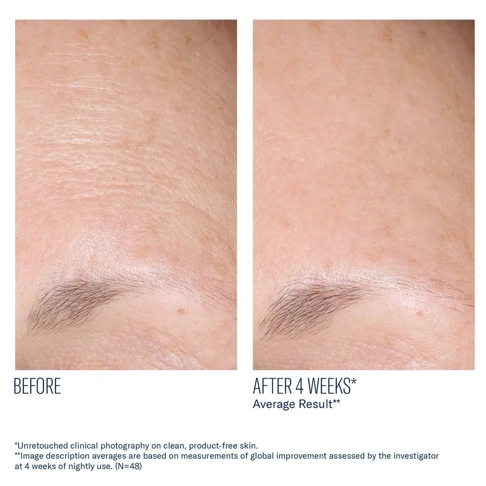 SkinBetter AlphaRet Overnight Cream  before and after comparison of forehead wrinkles with text indicating a 4-week result.