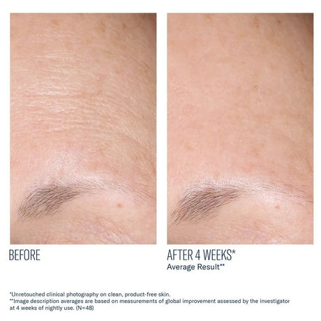 SkinBetter AlphaRet Overnight Cream  before and after comparison of forehead wrinkles with text indicating a 4-week result.