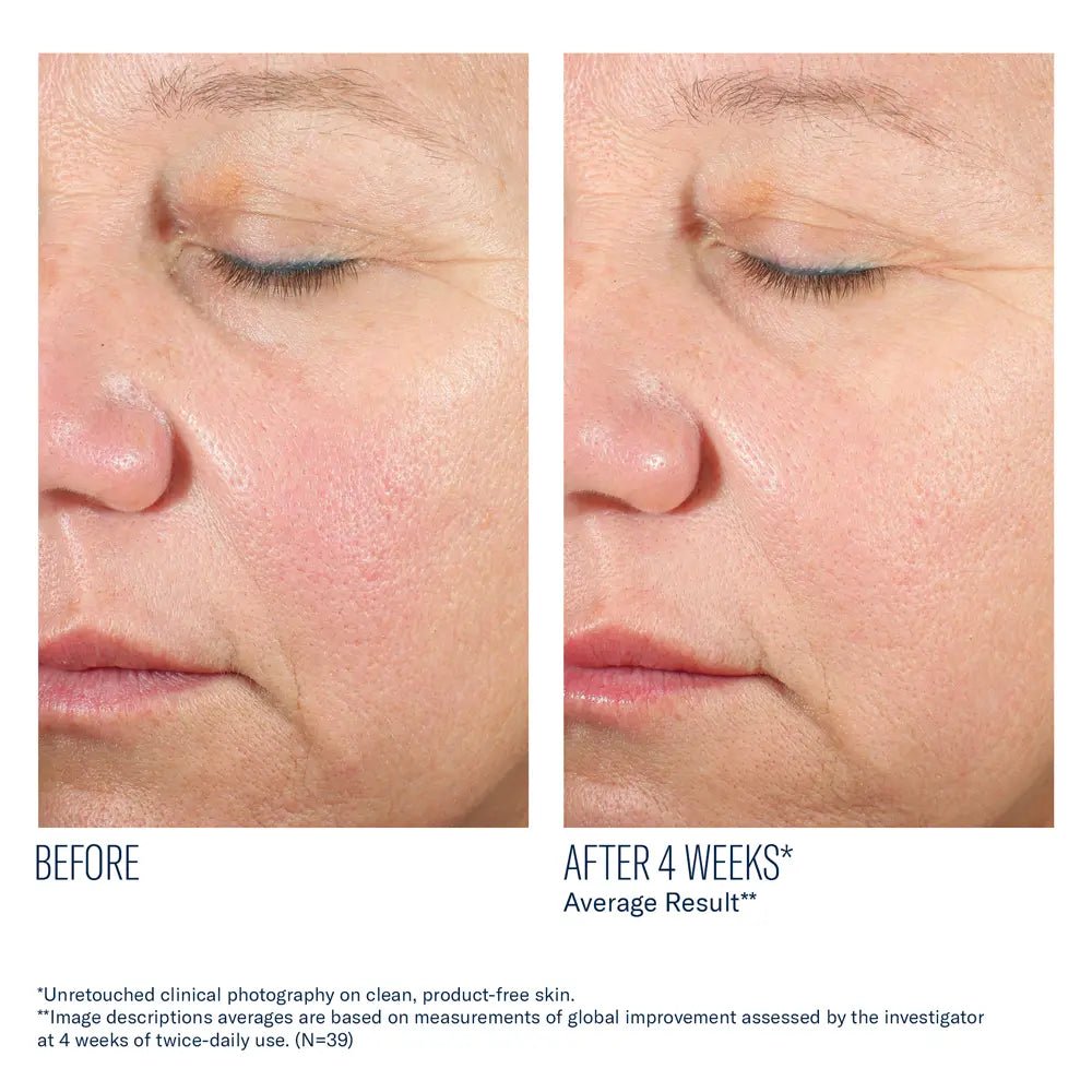 SkinBetter Alto Advanced Sefense and Repair Serum before and after comparison of facial skin with visible improvement after 4 weeks.
