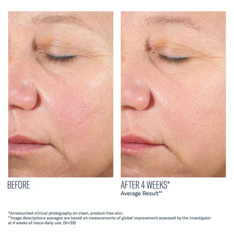 SkinBetter Alto Advanced Sefense and Repair Serum before and after comparison of facial skin with visible improvement after 4 weeks.