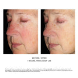 SkinBetter Alto Defense Serum