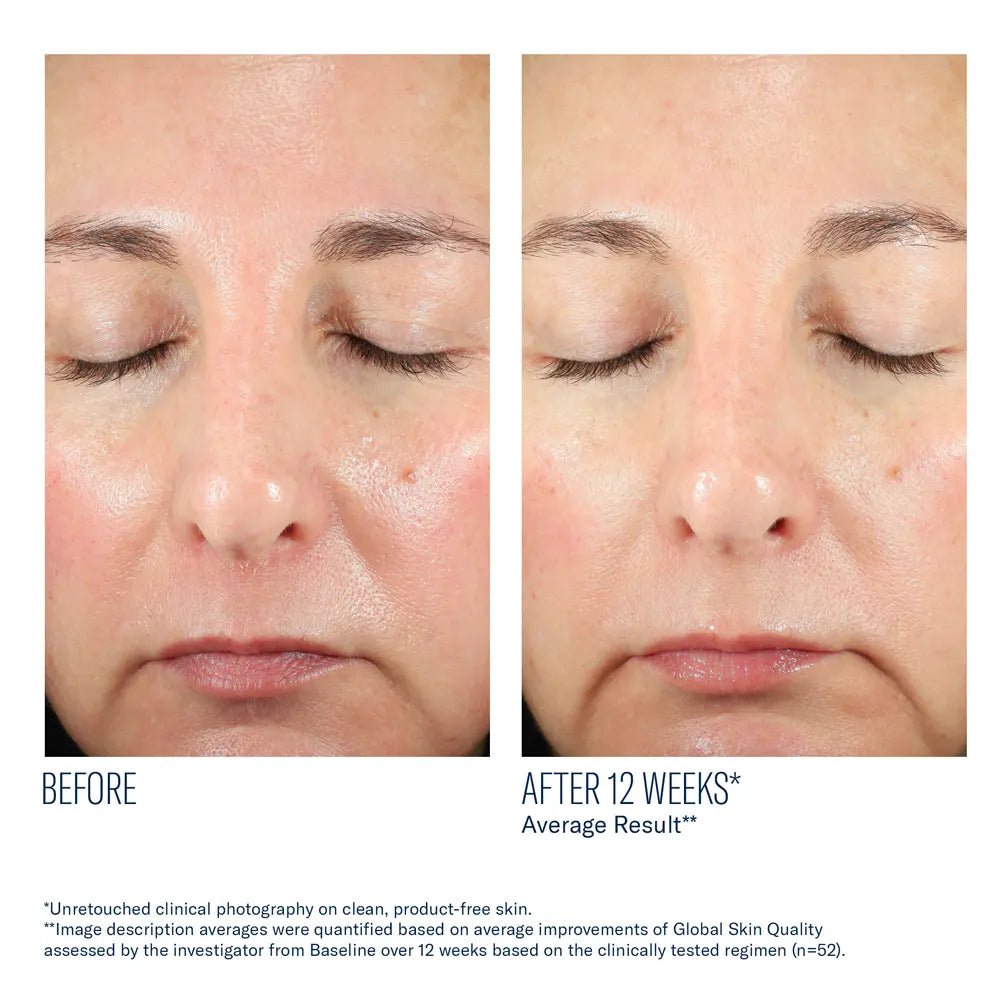 Before and after comparison of a person's face with text indicating a 12-week improvement while taking SkinBetter BioRewind Skin Health Dietary Supplement