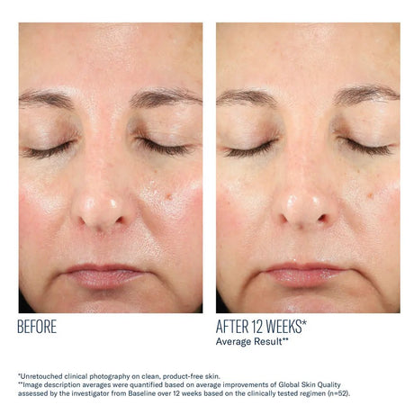 Before and after comparison of a person's face with text indicating a 12-week improvement while taking SkinBetter BioRewind Skin Health Dietary Supplement