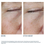 Before and after comparison of under-eye skin with text indicating improvement after 4 weeks using SkinBetter Instant Effect Gel EYE