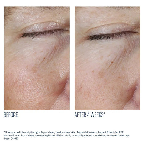 Before and after comparison of under-eye skin with text indicating improvement after 4 weeks using SkinBetter Instant Effect Gel EYE