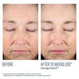 Before and after comparison of facial skin with visible improvements after 16 weeks using SkinBetter Mystro Revive Renewing Serum