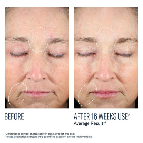 Before and after comparison of facial skin with visible improvements after 16 weeks using SkinBetter Mystro Revive Renewing Serum