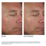 Before and after comparison of a man's face with text indicating a 4-week treatment effect using SkinBetter Solo Hydrating Defense Men