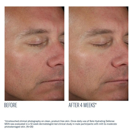 Before and after comparison of a man's face with text indicating a 4-week treatment effect using SkinBetter Solo Hydrating Defense Men