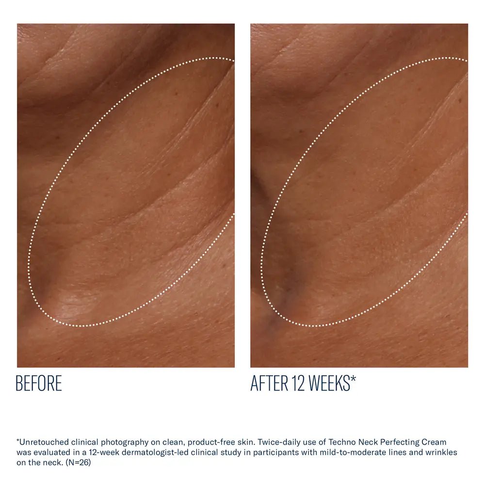 SkinBetter Techno Neck Perfecting Cream  before after resulls rejuvenated neck