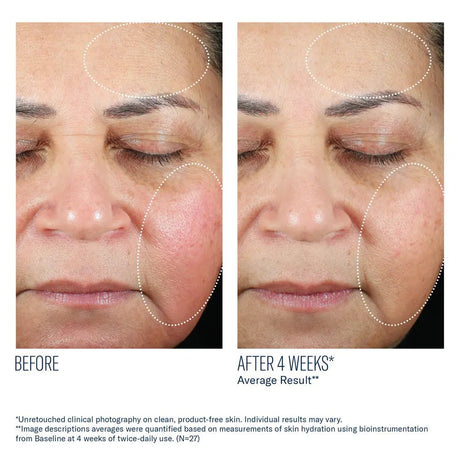 glp 1 skin serum reviews A New Era in Anti-Aging: How A.G.E. Interrupter Ultra Helps GLP1 Patients Maintain Youthful The Rise of GLP-1 Skincare