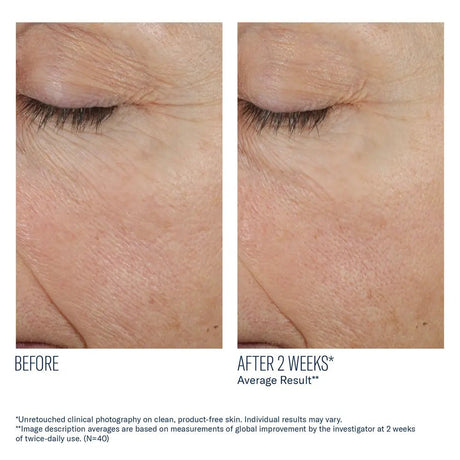Before and after comparison of eye area skin texture improvement on a person's eyelid with SkinBetter Trio Rebalancing Moisture Treatment