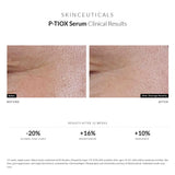 SkinCeuticals P-Tiox Anti-Wrinkle Serumb before and after less pores results