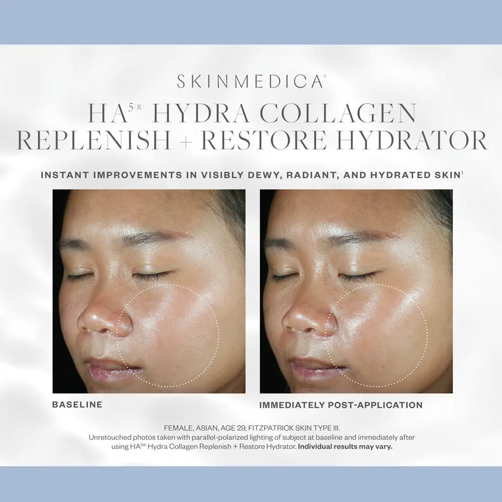 SkinMedica HA5 Hydra Collagen Replenish + Restore Hydrator