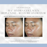 SkinMedica HA5 Hydra Collagen Replenish + Restore Hydrator