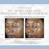 SkinMedica HA5 Hydra Collagen Replenish + Restore Hydrator