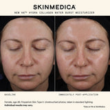 SkinMedica HA5 Hydra Collagen Water Burst Moisturizer