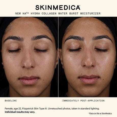SkinMedica HA5 Hydra Collagen Water Burst Moisturizer