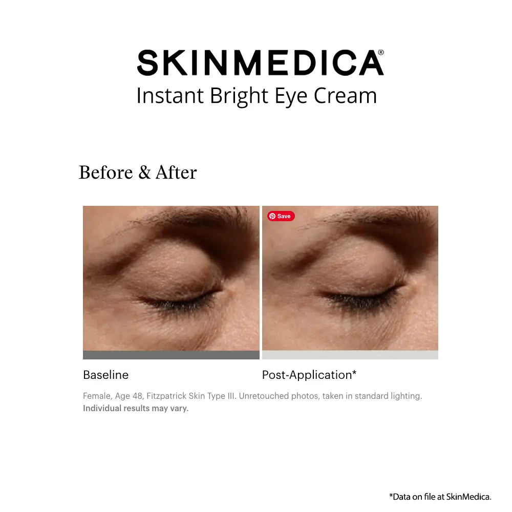 Before and after comparison graphic for Skinmedica Instant Bright Eye Cream, showing close-up photos of a closed eye labeled Baseline and Post-Application on a white background.
