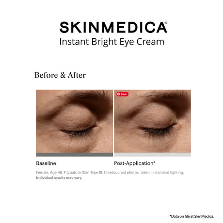 Before and after comparison graphic for Skinmedica Instant Bright Eye Cream, showing close-up photos of a closed eye labeled Baseline and Post-Application on a white background.