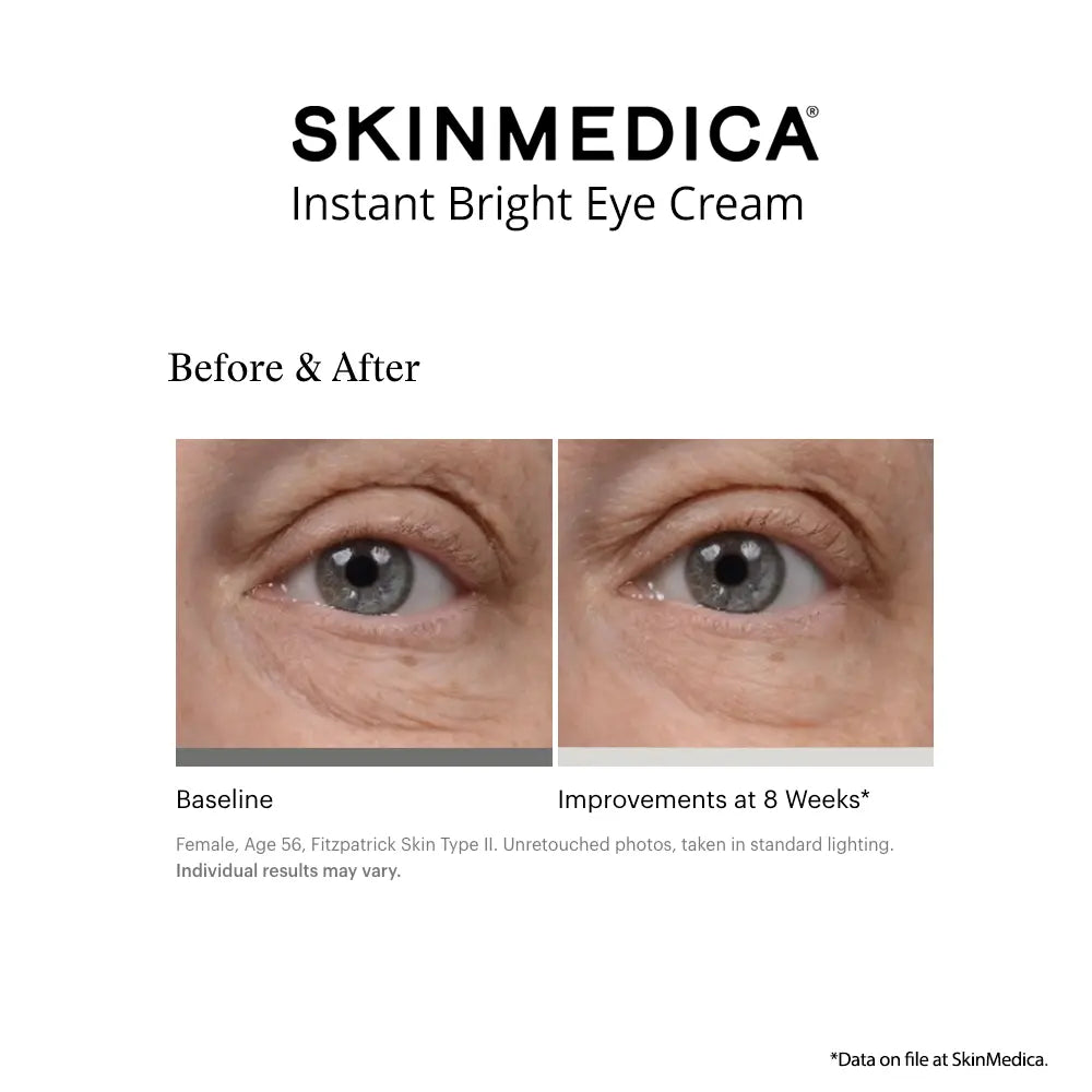 Before and after comparison of a person's eye area showing wrinkle improvement over 8 weeks, with the text 'SKINMEDICA Instant Bright Eye Cream' at the top on a white background.